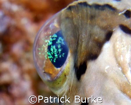 Puffer Eye with green stuff !  E900 with twin Inon Strobes by Patrick Burke 