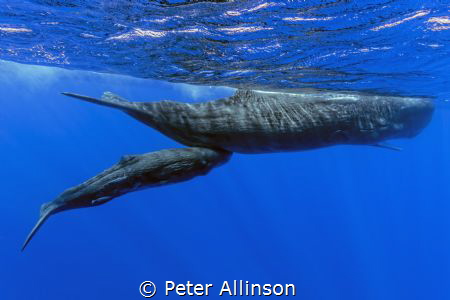 Baby sperm whale nursing, taken under permit by Peter Allinson 