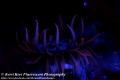 Beautifully fluorescent anemone