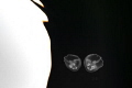 A jelly reflection A jelly reflection