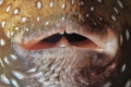 Parched lips Parched lips