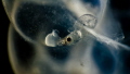 The development of SQUID is visible in the picture. These eggs are about 3mm in diameter and when the little squid inside has used up all the nutrients in that 