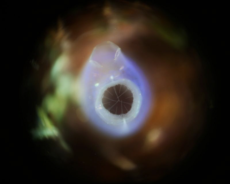Turnicate RRM by Jun V Lao 