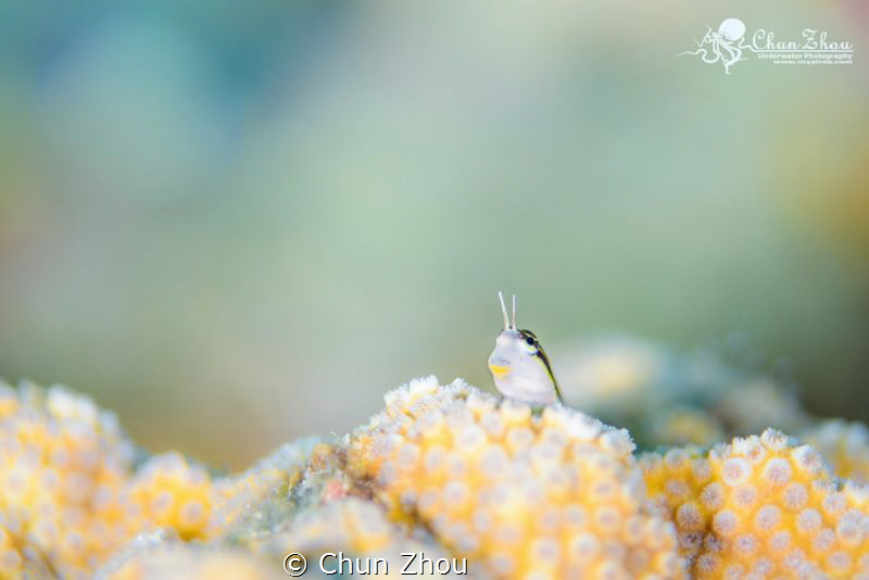what are you missing? by Chun Zhou 