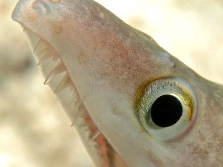 Eye and teeth. by David Heidemann 