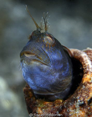Holding your breath until you turn blue? eh?? Well, it se... by Suzan Meldonian 