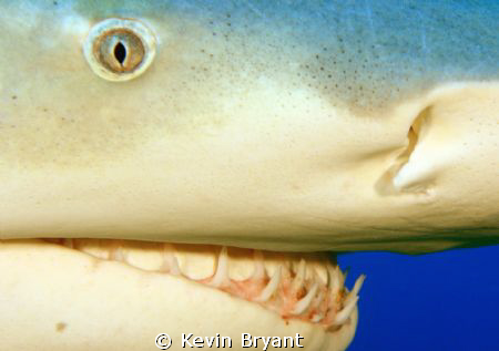 Periodontal exam by Kevin Bryant 
