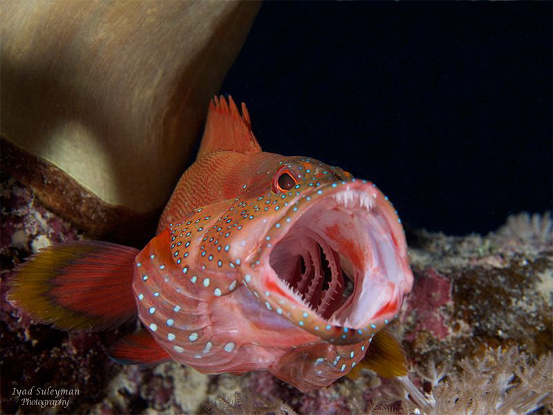 Say Ahhh! by Iyad Suleyman 