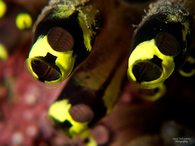 Abstract 
taken with +15 wetdiopter by Iyad Suleyman 