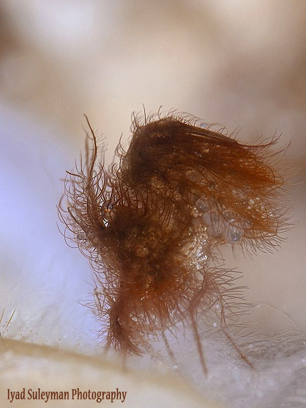 Hairy shrimp with eggs
(inside shell)
 by Iyad Suleyman 