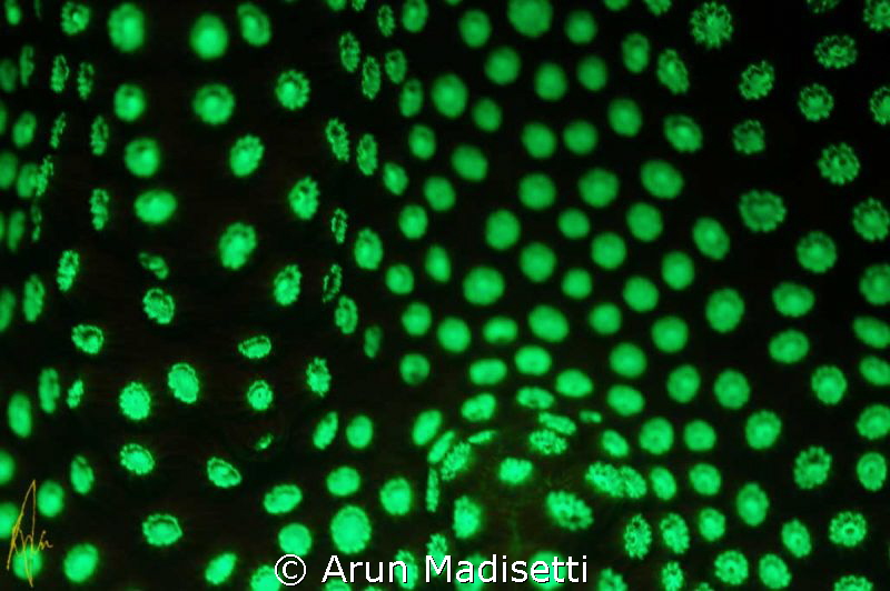 1st attempt at fluorescence. quite frustrating by Arun Madisetti 