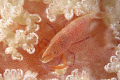 I'm glad we don't have shrimp wandering around our lungs