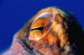 Octopus eye's.